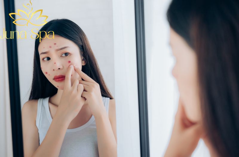Vết thâm và sẹo rỗ xuất hiện sau khi tự xử lý mụn