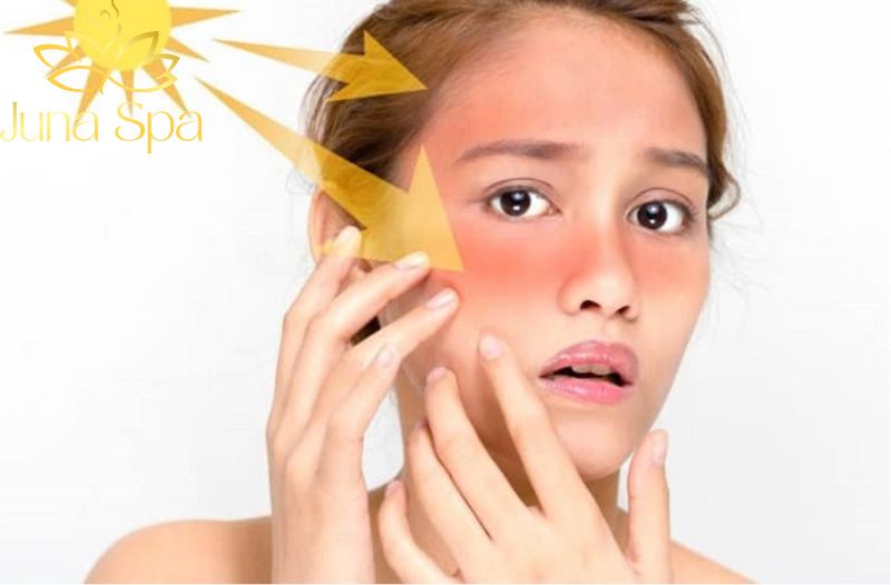 Các phương pháp trị nám do tia UV