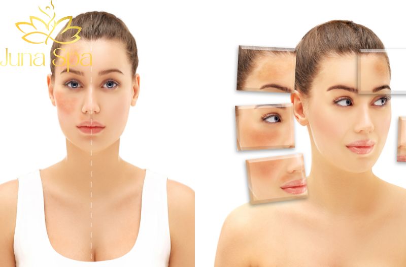 Tàn nhang không liên quan đến sức khỏe