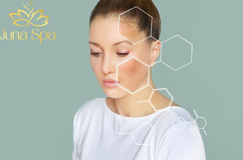 Trị nám kết hợp với duy trì lâu dài