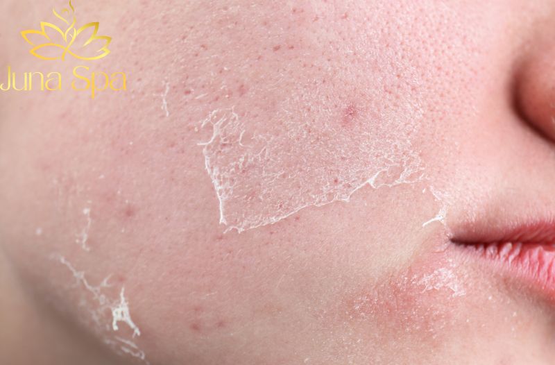 serum cho làn da nhạy cảm
