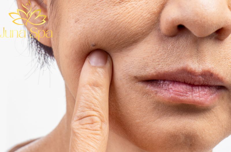 Triệu chứng và cách nhận biết viêm da cơ địa vào mùa hè