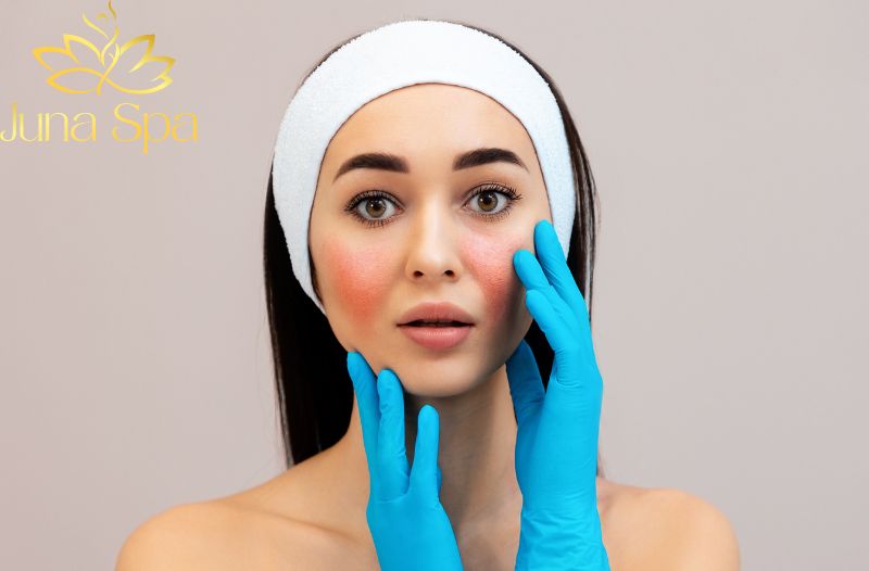 Cách chọn serum không gây kích ứng cho da nhạy cảm