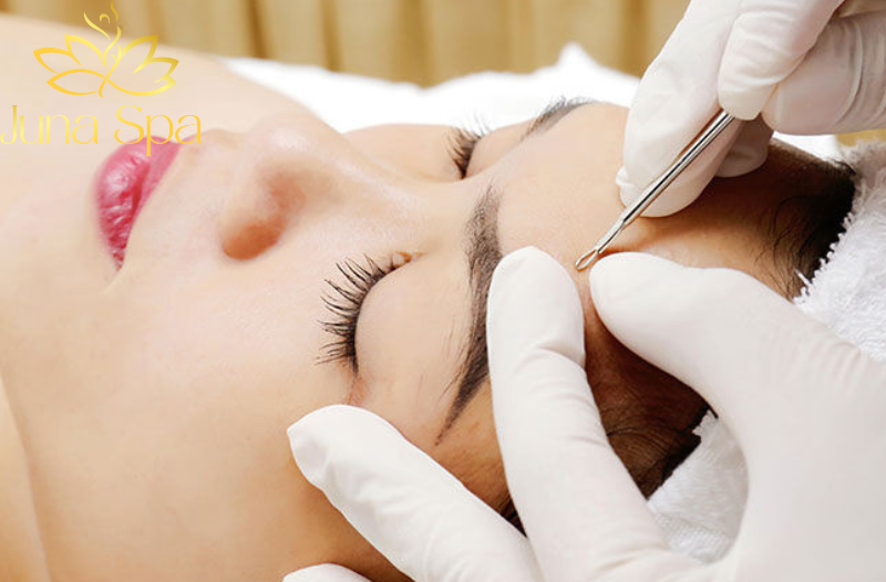 Những kiến thức bắt buộc phải biết khi học trị mụn