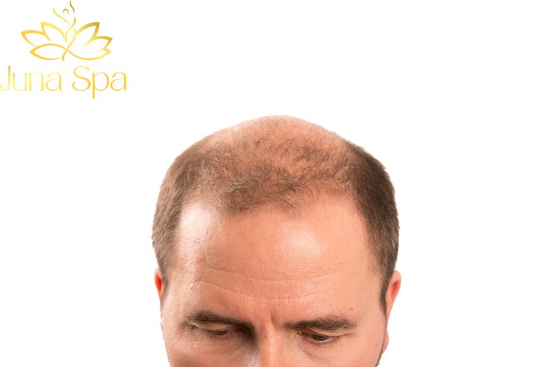 Do mắc bệnh lý hoặc thiếu dưỡng chất