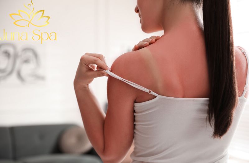 Da bị cháy nắng liệu có phục hồi được không?