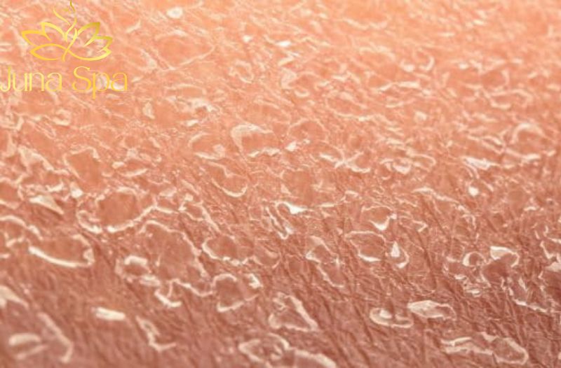 5 bước chăm sóc da sần sùi hiệu quả