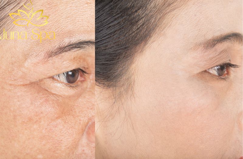 Bảo vệ mắt trước ánh sáng xanh và tia UV