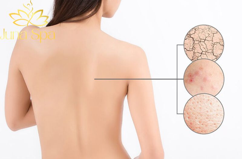 Nguyên nhân gây ra da sần sùi