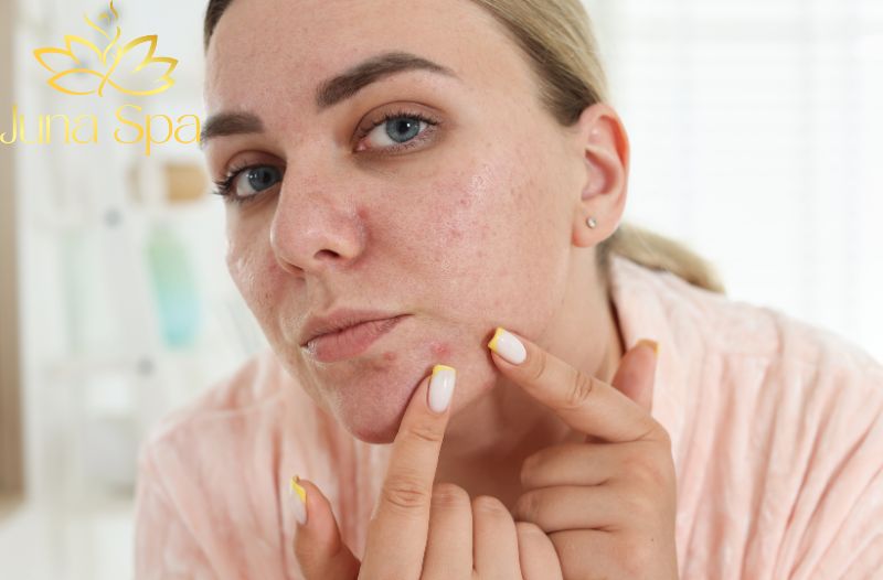 Làm thế nào để giảm stress và hỗ trợ da hồi phục