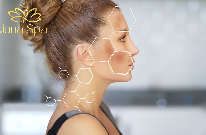 Vì sao không phải cứ ra nắng là sẽ bị nám