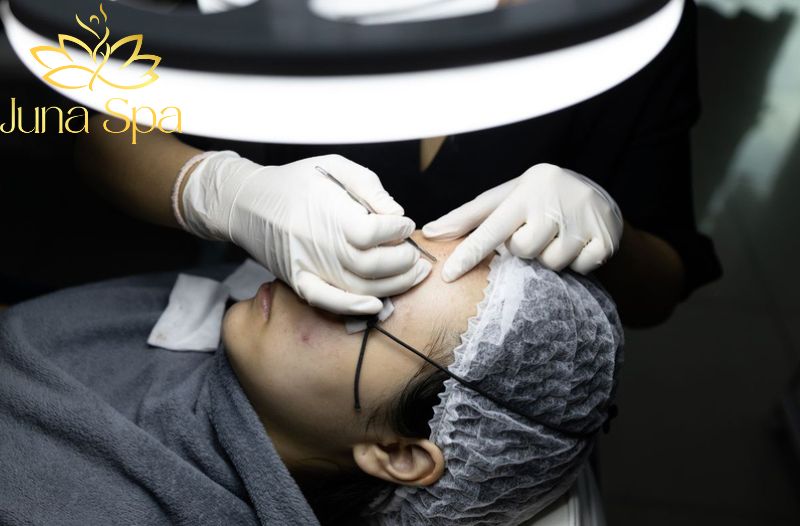 Sau liệu trình: phản ứng da và giai đoạn phục hồi cần lưu ý