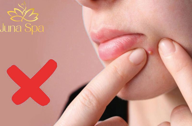 Hậu quả của việc nặn mụn sai cách