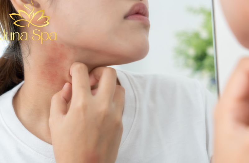 Những vấn đề da dễ gặp dịp cuối năm và cách phòng ngừa hiệu quả
