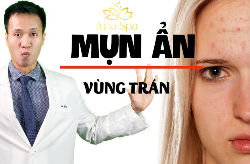 Mụn ẩn vùng trán bùng phát khi stress: Cách chăm da trong giai đoạn nhạy cảm