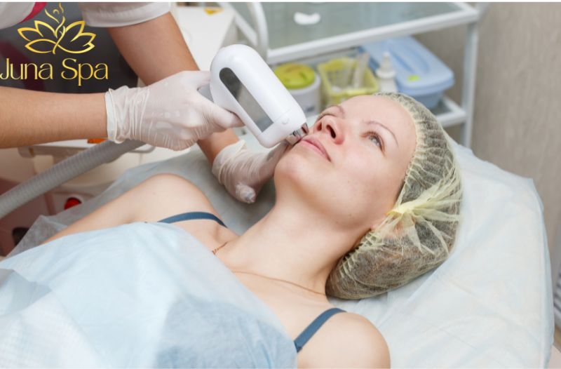 Triệt lông mép bằng công nghệ Hàn Băng ICE PRO tại Juna Spa