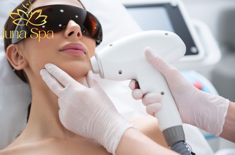 Triệt lông mép - giải pháp giúp gương mặt tươi tắn và tự tin hơn