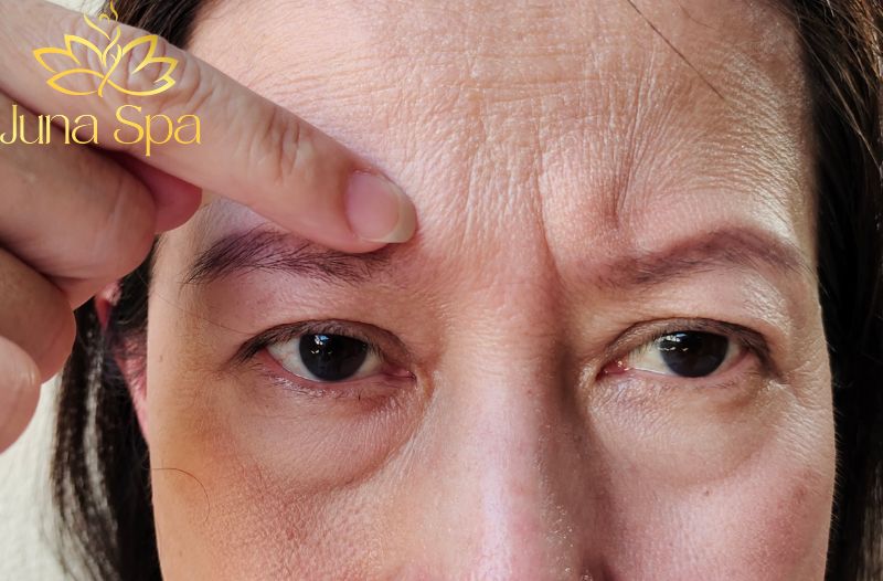 Những thói quen khiến nếp nhăn giữa hai chân mày rõ hơn