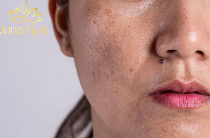 Da sạm và kém đàn hồi vì tác động của rượu bia