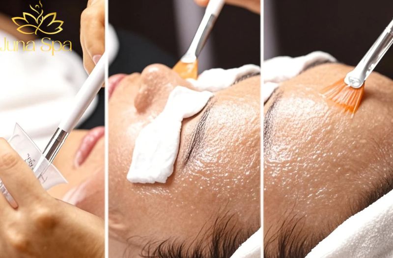 So sánh mụn ẩn ở trán - má - cằm: Vì sao vùng trán thường khó xử lý hơn?
