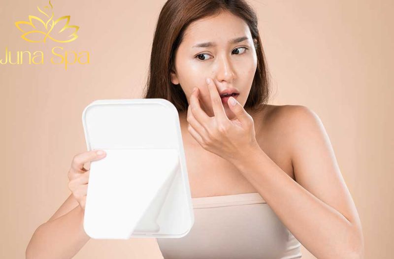 Mụn li ti là gì? Vì sao da dễ xuất hiện mụn li ti?