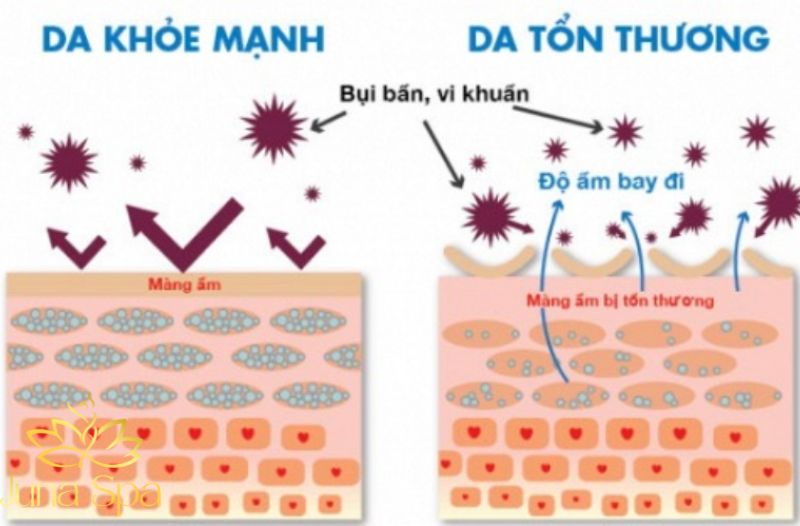 Tẩy tế bào chết quá mức khiến da mất đi lớp bảo vệ tự nhiên