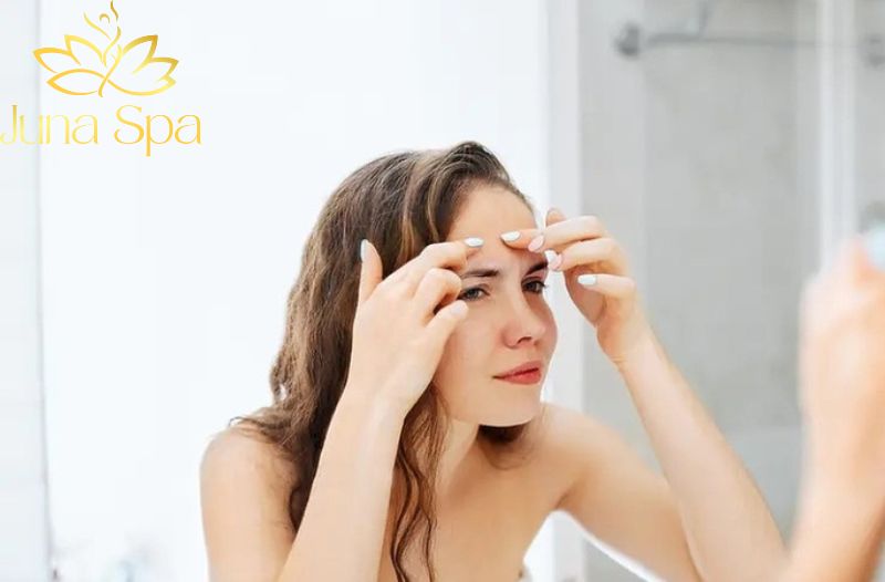 Vì sao càng skincare thì vùng trán càng nổi mụn ẩn?