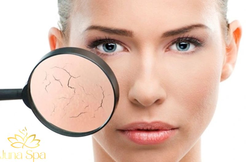 Những điều khiến hàng rào da yếu đi mà nhiều người không ngờ tới