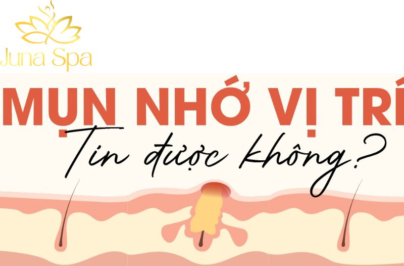 nhớ vị trí mụn