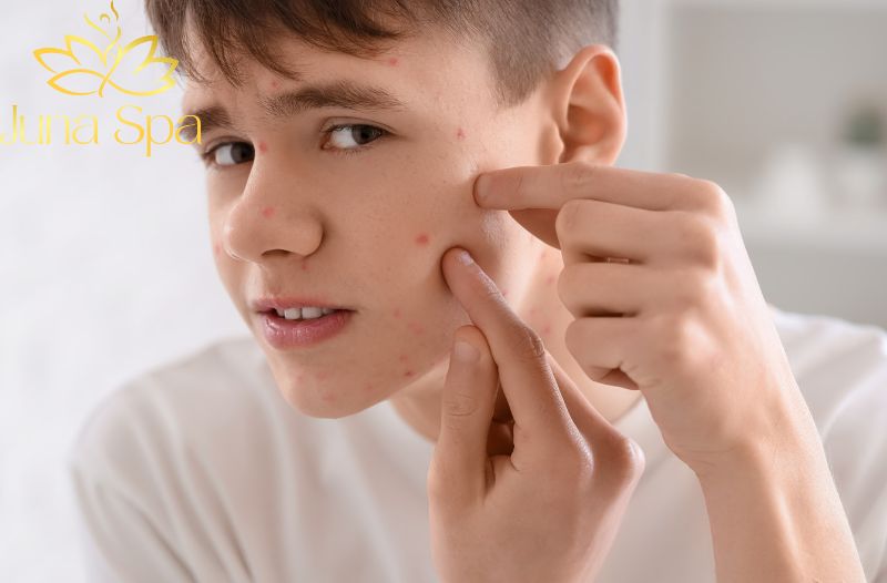 Chăm sóc từng vùng da để giảm nguy cơ xuất hiện mụn ẩn