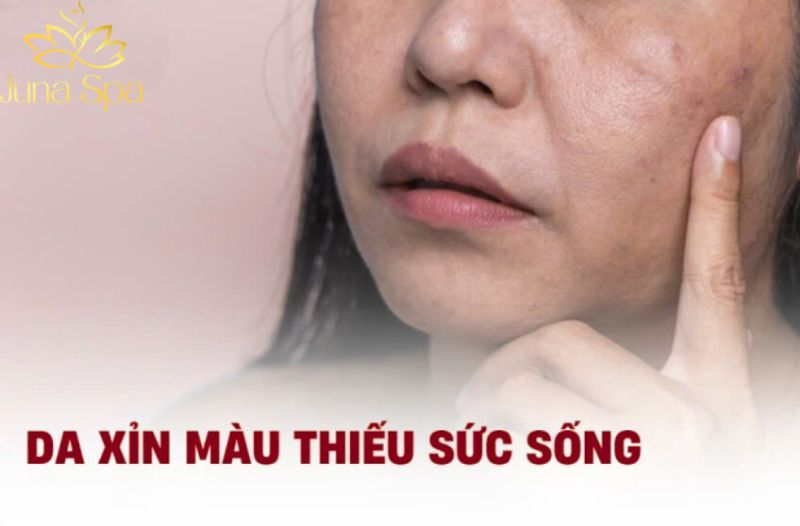 Mẹo chăm sóc da khi da xỉn màu, kém tươi do thức khuya liên tục