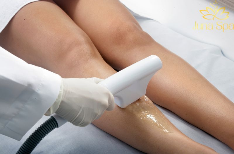 Thời điểm triệt lông trước Tết bao lâu là hợp lý?