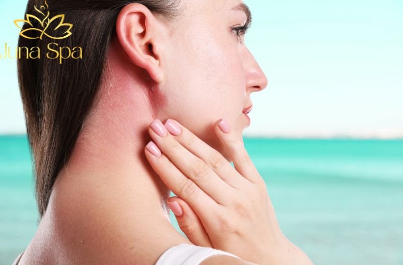 Phục hồi da trước Tết nên tập trung vào điều gì