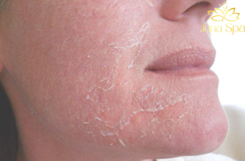 Đừng quên chăm sóc da từ bên trong