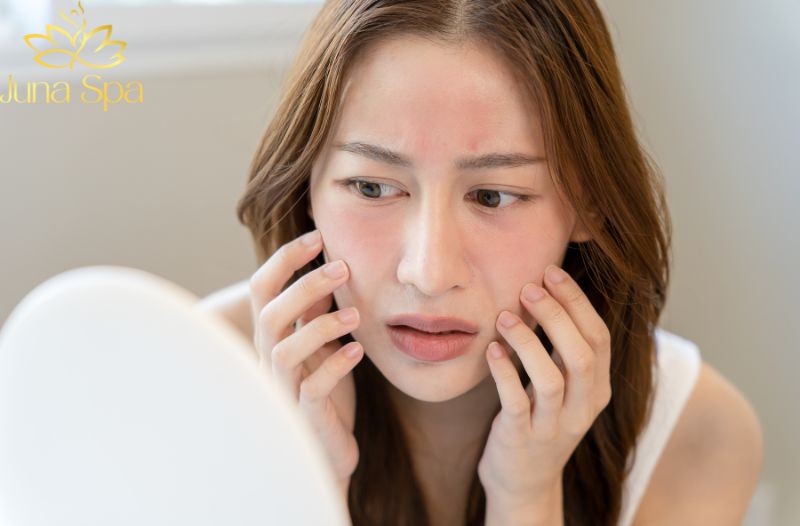 Da nhạy cảm hơn, dễ đỏ và khó thích nghi