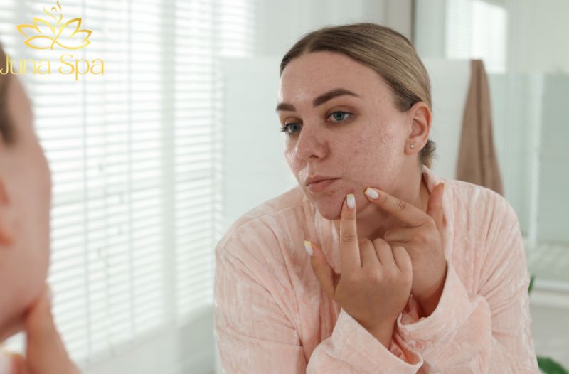Làm dịu và ổn định làn da nhạy cảm