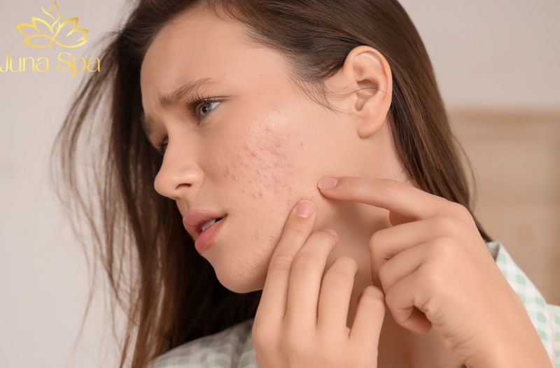 Chế độ ăn nhiều dầu mỡ và đường ảnh hưởng trực tiếp đến da