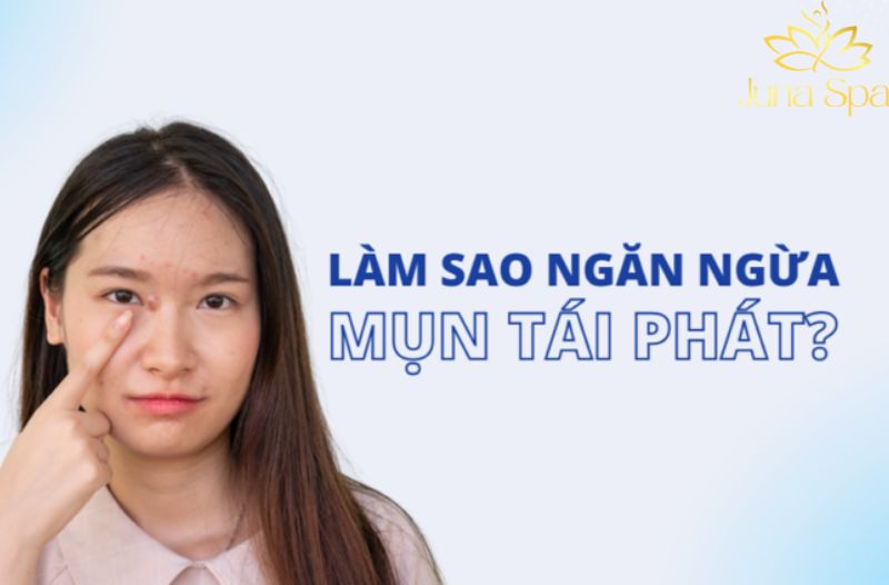 Vì sao mụn thường lặp lại ở cùng một vị trí