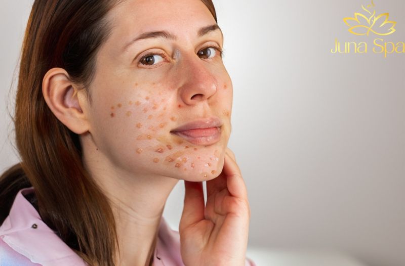 Dưỡng ẩm và cân bằng giúp da ổn định hơn