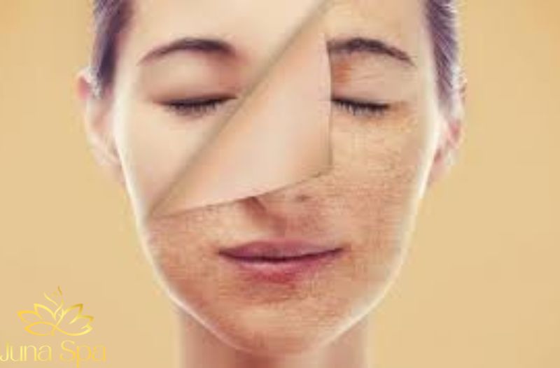 Da kém đàn hồi và thiếu độ căng mịn