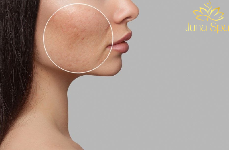 Khi da xuất hiện nhiều dạng thâm cùng lúc