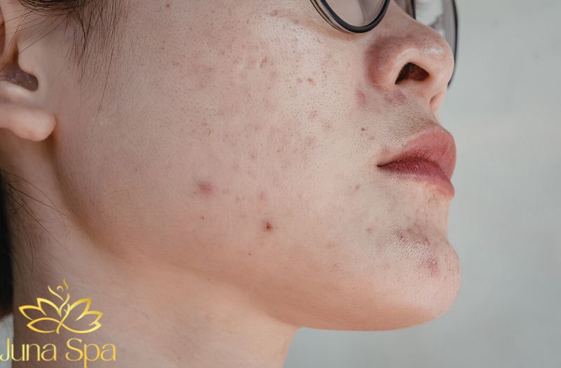 Thói quen sinh hoạt có thể ảnh hưởng đến từng vùng da