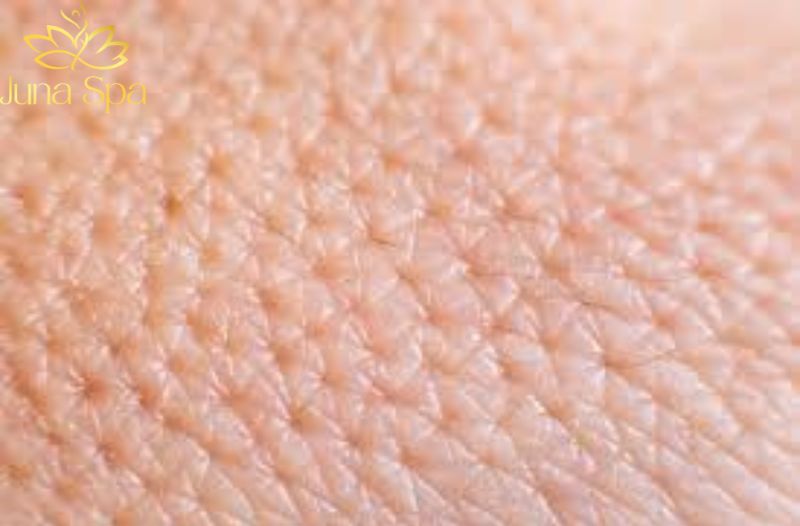 Lỗ chân lông to ảnh hưởng thế nào đến bề mặt da