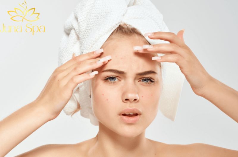 Làm sạch chưa phù hợp với tình trạng da