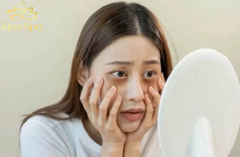 Da khô sần, kém đàn hồi