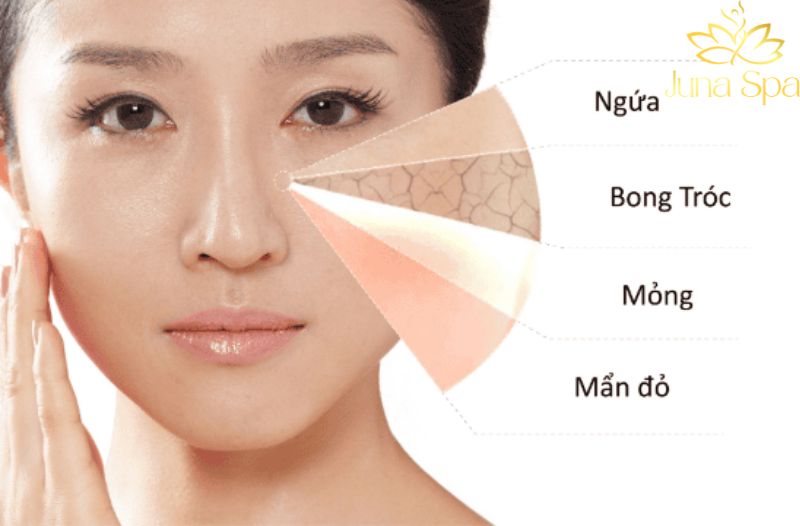 Chăm sóc da sau Tết nên tập trung điều gì
