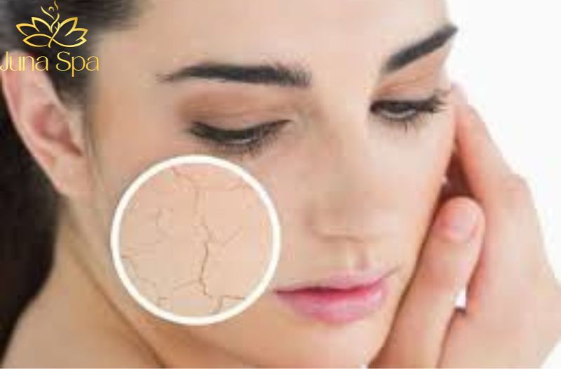 Dấu hiệu nhận biết da đang bị quá tải mỹ phẩm
