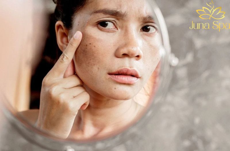 Da xỉn màu và thiếu sức sống