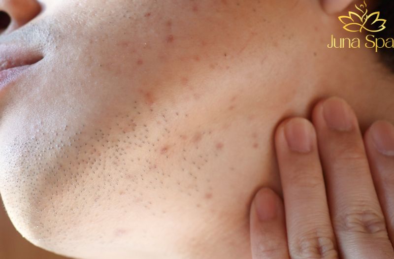 Làm sạch da đúng mức để giảm áp lực cho lỗ chân lông