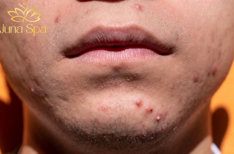 Điều chỉnh thói quen sinh hoạt để hỗ trợ da từ bên trong